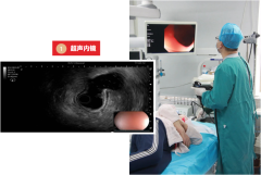 丁义山专科澳门402com永利平台登录超声内镜检查技术，胃肠疾病诊断透视眼